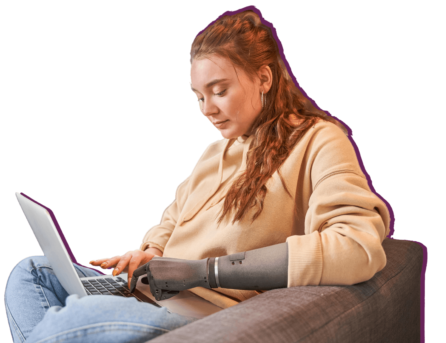 A young woman with a prosthetic arm is typing on her laptop, hard at work.